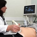 VanessaPalmerBlas/ultrasoundwhenshewaspregnant.jpg